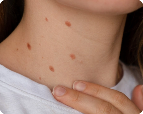 online skin lesion assessment
